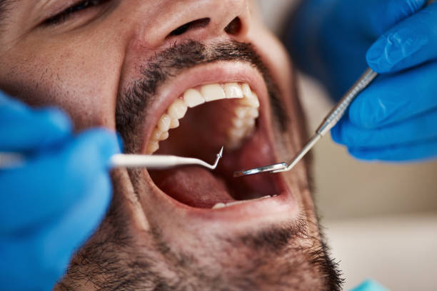 Best Emergency Gum Pain Relief  in Marbury, AL