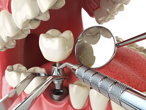 Best Urgent Tooth Repair  in Marbury, AL